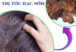 Bài thuốc Đông y chữa tóc bạc sớm hiệu quả