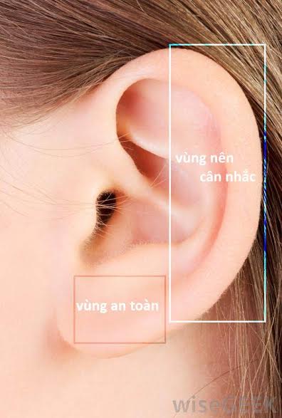 Bấm lỗ tai sai cách dẫn tới biến chứng nguy hiểm